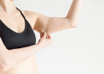 Braquioplastia: la cirugía que corrige la flacidez de los brazos